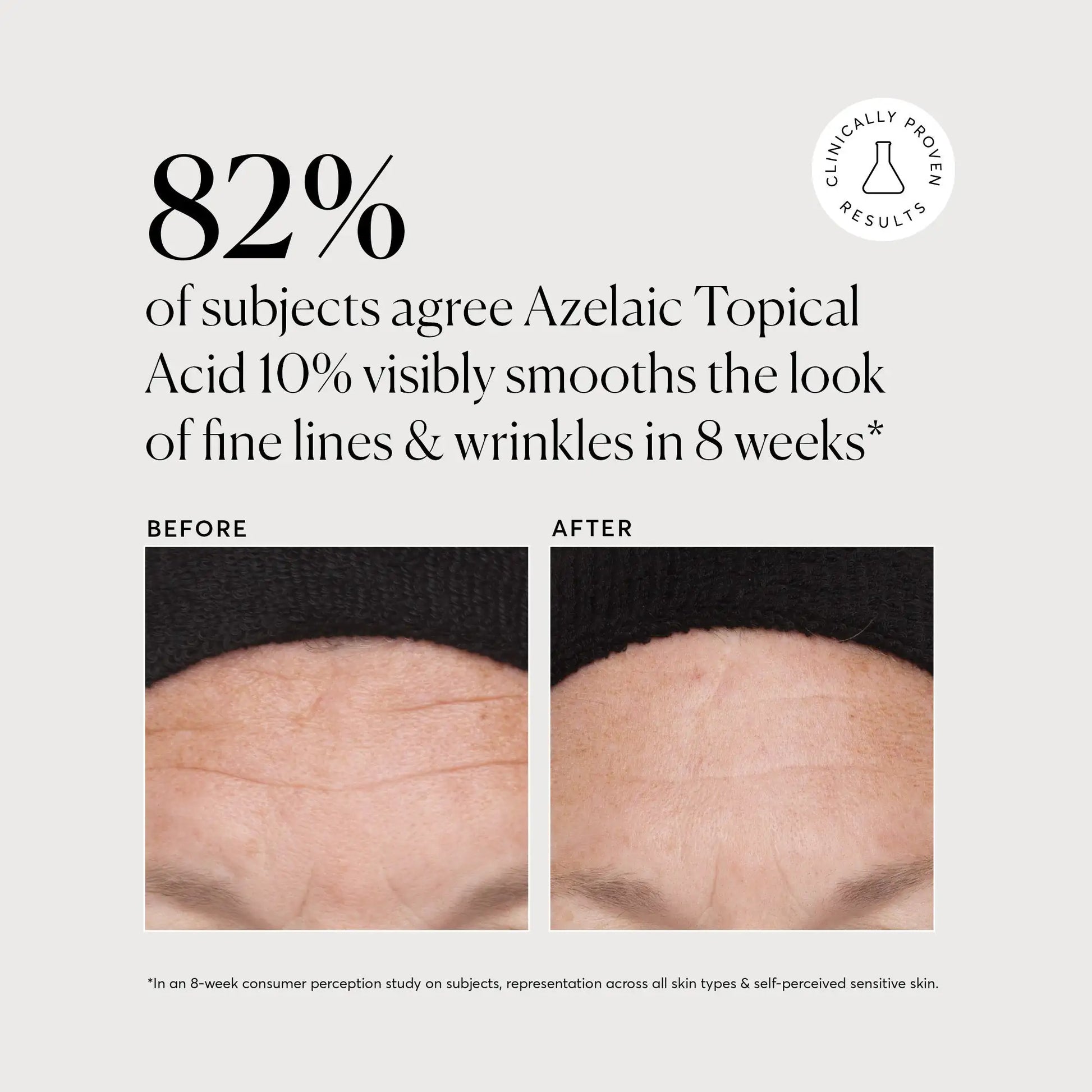 Azelaic Acid Derivative Complex 10% - Jumbo