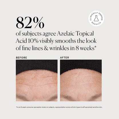 Azelaic Acid Derivative Complex 10% - Jumbo